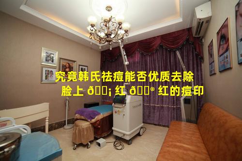 究竟韩氏祛痘能否优质去除脸上 🐡 红 💮 红的痘印
